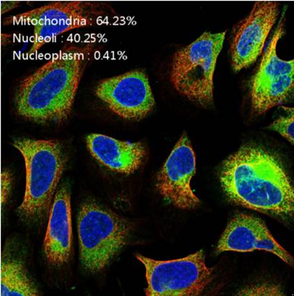 �����|(zh��)����u��